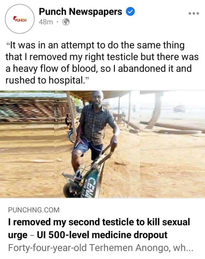 Man Amputates His Second Testicle To Kill S.exual Desire (See Photos)