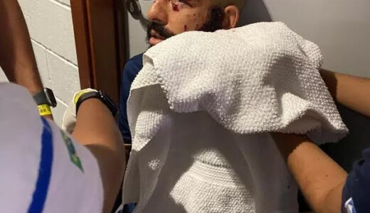 Bomb explodes on Brazilian team Bahia’s team bus, injuring three (photos)