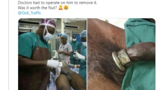 Metal Nut Stuck In Man’s P3nis While He Was Masturbating With It (See Photos +18)