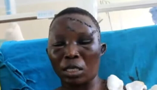 Man hacks wife with machete for denying him s*x (Photos)