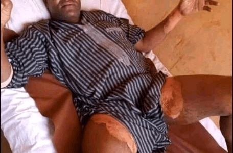 Wife Pours Hot Water On His Husband Over Decision To Take A Second Wife (See Photos)