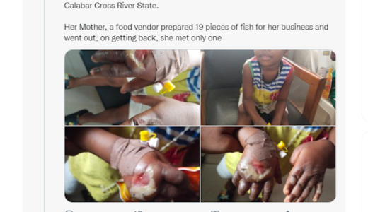 Sad Video|| Mother dips five-year-old daughter’s hands in hot water for eating 18 out of 19 fishes meant to be sold