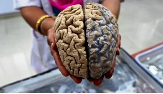 You Are Slowly Killing Your Brain If You Keep Doing These Three (5) Things, Don’t Ignore