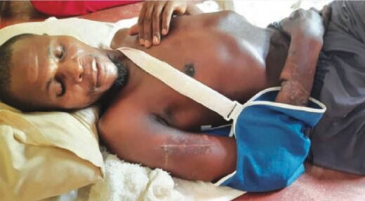 Man Miraculously Survives Vicious Attack by at Least Three Crocodiles