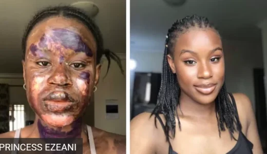 ‘I Doubted If Any Man Would Accept To Marry Me Any Time I Look At Myself’ – Princess