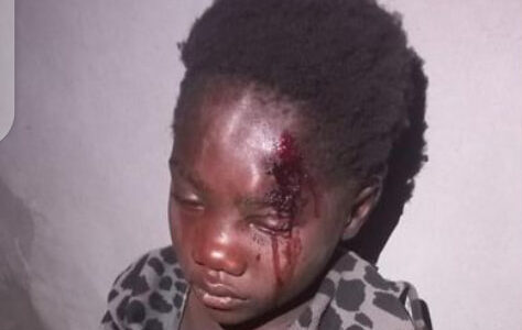 Zambia police detain pregnant woman for assaulting her child (Photo)