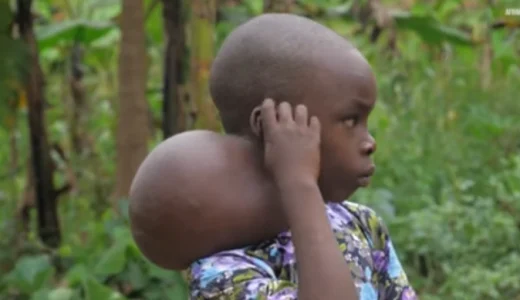 Boy with neck tumour can now smiles again after donations that facilitated his surgery