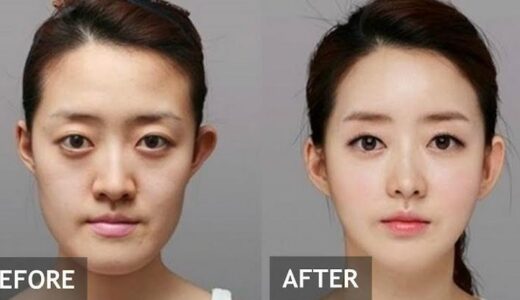 Why South Korea is the plastic surgery capital of the world
