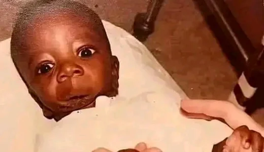 He was born with half of his Face Missing, See what he Now Does to Earn a living