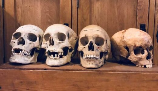 Zambia Police arrest 2 men found in possession of human skulls