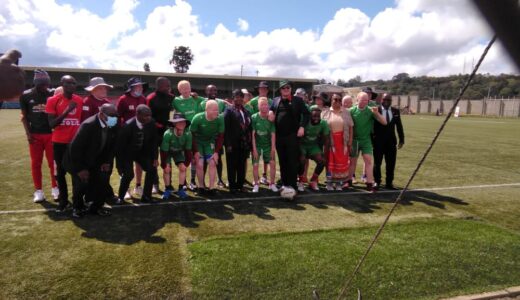 Malawian Albinos Demand Sunscreen Lotion from Government