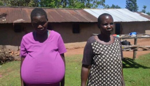 Remember This Woman? Found Out What Doctors Have Removed From Her Breasts After Successful Surgery