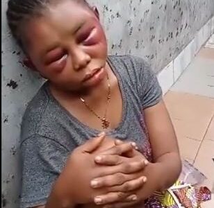 Watch|| Nigerian 19-Year-Old Girl Beaten To Pulp By Her Boyfriend