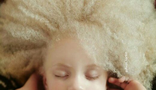 The most beautiful albinos in the world