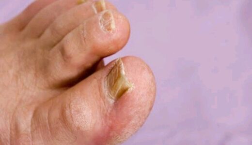 HIV Earliest signs that you should know