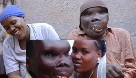 25 years after marrying world’s ugliest man, having 8 kids, woman speaks (video)