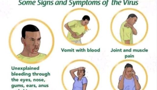 Malawi Govt monitors deadly Marburg virus outbreak in Tanzania’s North-West Kagera region