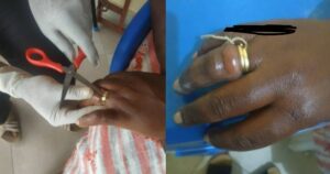 Bizarre As Woman Nearly Lose Her Finger After Buying Wedding Ring From Friend