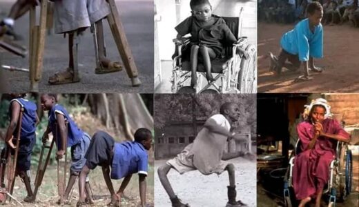 Blantyre polio immunasation  targets over 600,00 children