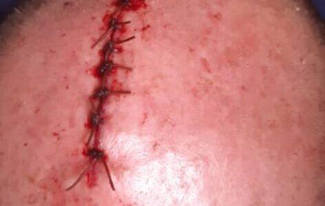 Court yet to move on hacked husband case 