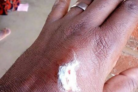 Stray Police Bullet Injures Two National Bank Customers in Salima (See Photos)