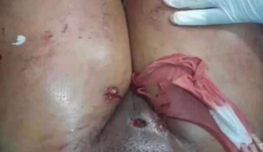 See Photos Of A Lady Who Was Shot On Her Pvssy After She Was Caught Cheating By Her Man, This Is Ridiculous (Watch Video)