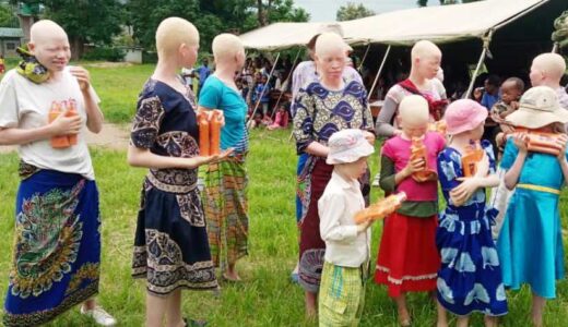 People with Albinism still ‘living in fear’ in Malawi