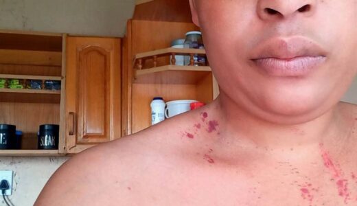 South African woman brutally beaten by her police officer boyfriend